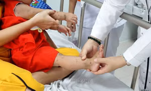Lâm Đồng: Khẩn trương phòng chống bệnh dịch sốt xuất huyết, tay chân miệng 