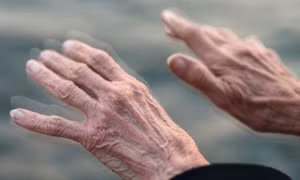 Phát triển công nghệ chẩn đoán sớm bệnh Parkinson
