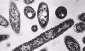 Australia cô lập và xử lý nguồn dịch bệnh legionnaires gây chết người