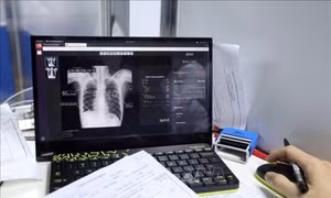 Sử dụng lại 1% kết quả xét nghiệm có thể tiết kiệm khoảng 300 tỷ đồng mỗi năm