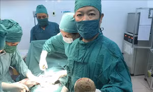 Lấy thành công viên sỏi gần nửa kg khỏi bàng quang bệnh nhân