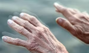 Lần đầu quan sát được 'mồi lửa' khởi phát bệnh Parkinson