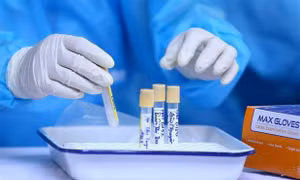  Bảy trường hợp F1 tại Thành phố Hồ Chí Minh có kết quả âm tính lần 1