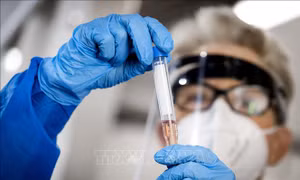 Nga phát triển công nghệ phát hiện virus SARS-CoV-2 ở giai đoạn sớm