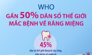 Gần 50% dân số thế giới mắc bệnh về răng miệng