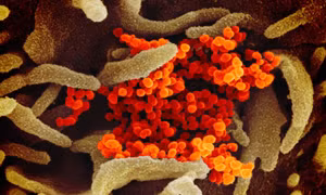 Phát hiện biến thể của chủng virus SARS-CoV-2 tại Malaysia