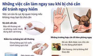 Những việc cần làm sau khi bị chó cắn để tránh nguy hiểm