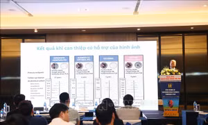 Các kỹ thuật chẩn đoán và điều trị tim mạch của Việt Nam đã vươn tầm thế giới