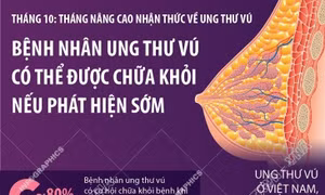 Bệnh nhân ung thư vú có thể được chữa khỏi nếu phát hiện sớm