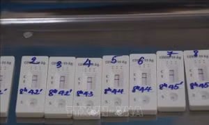 Khuyến cáo người tiêu dùng khi mua kit test nhanh COVID-19