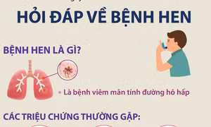 Ngày Hen toàn cầu 2/5: Hỏi đáp về bệnh hen