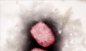 Bỉ giải trình tự gen của virus gây bệnh đậu mùa khỉ