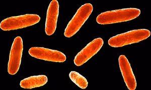 Mexico: Thêm nhiều trẻ em tử vong do nhiễm vi khuẩn Klebsiella oxytoca