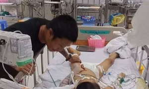Bé 7 tuổi ngưng tim, hôn mê sau ca mổ lấy đinh nẹp ở tay