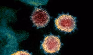 Ca mắc hiếm gặp khi nhiễm cùng lúc 2 biến thể của virus SARS-CoV-2