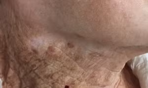 Bức ảnh gây bão về hệ quả 40 năm chỉ dùng kem chống nắng cho mặt