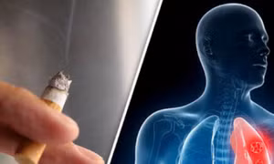 9 ca ung thư phổi đầu tiên từ nghiên cứu mới ở Singapore đều là người không hút thuốc