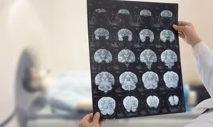 AI mở ra hướng giải mã những bí ẩn y học cho bệnh nhân