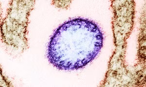 Các cơ sở y tế chủ động phòng, chống  bệnh do virus Nipah