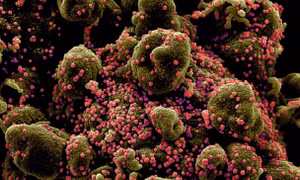 Phát hiện sinh vật đầu tiên trên thế giới chỉ ăn virus để sống