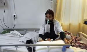 Phát hiện mầm bệnh bí ẩn ở Afghanistan gây sốt cao và chảy máu mũi, hai bệnh nhi đã tử vong 