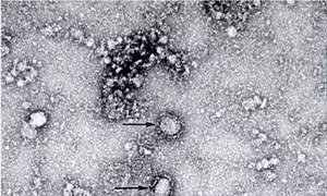 Xử lý nghiêm trường hợp bịa đặt dịch viêm đường hô hấp cấp do virus Corona