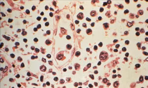 Argentina đặt những chiếc bẫy đầu tiên nhằm tóm vật chủ mang virus Hanta