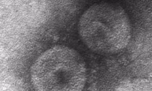 Virus Corona chỉ gây bệnh cho chó lại xuất hiện ở người viêm phổi