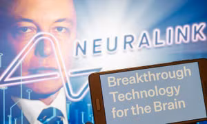 Dự án cấy chip vào não người của tỷ phú Elon Musk gặp trở ngại lớn