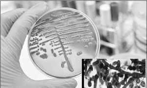 Nấm Candidozyma auris lan rộng tại châu Âu, đe dọa các bệnh viện