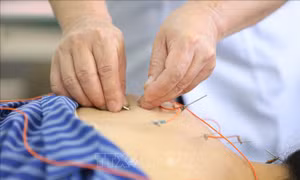 Tạo thuận lợi cho bệnh nhân khám, chữa bệnh bảo hiểm y tế trong lĩnh vực y học cổ truyền 
