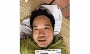 Lái xe không chấp hành hiệu lệnh gây chấn thương người thi hành công vụ