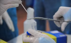 Tăng cường kiểm tra, giám sát giá dịch vụ chẩn đoán nhanh, xét nghiệm RT-PCR