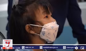 Cảnh báo lây lan bệnh đau mắt đỏ tại cộng đồng