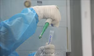 167 trường hợp liên quan đến bệnh nhân số 262 tại Bắc Ninh âm tính với virus SARS-CoV-2
