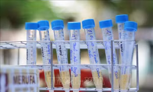 Đà Nẵng xét nghiệm virus SARS-CoV-2 cho tất cả thí sinh tham dự kỳ thi tốt nghiệp THPT đợt 2 