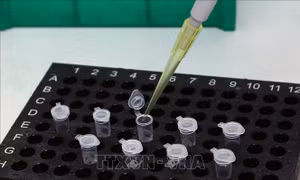Hòa Bình đưa vào sử dụng hệ thống máy sàng lọc, xét nghiệm virus SARS-CoV-2