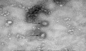 Bốn ca nghi nhiễm virus Corona ở Thái Bình có kết quả âm tính
