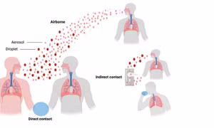 Trên 65.000 người nhiễm chủng các virus giống SARS-CoV ở Đông Nam Á mỗi năm 