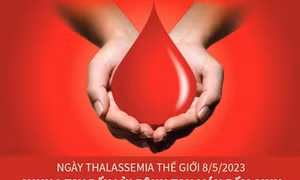 Chung tay đẩy lùi bệnh tan máu bẩm sinh