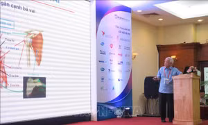 Giới thiệu nhiều liệu pháp điều trị bệnh lý cơ xương khớp mới