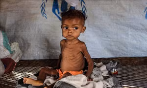 Cảnh báo về tình trạng trẻ em suy dinh dưỡng nghiêm trọng tại khu vực Sahel 