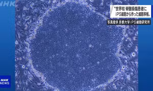 Ca thử nghiệm cấy ghép tế bào có nguồn gốc từ tế bào iPS đầu tiên trên thế giới