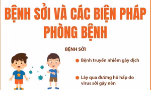 Bệnh sởi và các biện pháp phòng bệnh