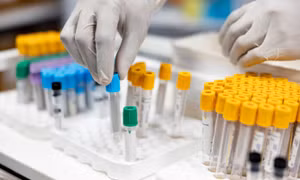 Australia thừa nhận làm mất 300 lọ mẫu virus gây chết người