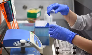 Nga phát triển phương pháp mới chống bệnh huyết khối