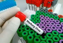 Tanzania tiếp tục ghi nhận trẻ em tử vong vì virus Marburg