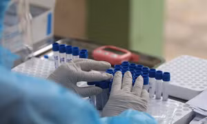 11 bệnh nhân COVID-19 tại Đà Nẵng có kết quả âm tính lần 1 với virus SARS-CoV-2