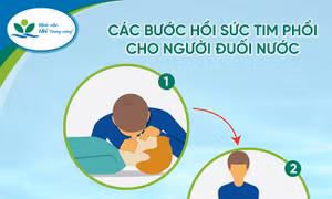 Sơ cứu đúng cách để cứu sống người bị đuối nước