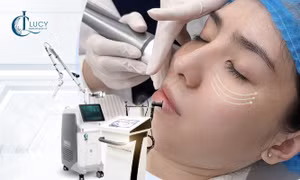 TP Hồ Chí Minh: Sau kỳ nghỉ Tết, hàng loạt cơ sở làm đẹp bị xử phạt và phải đóng cửa
